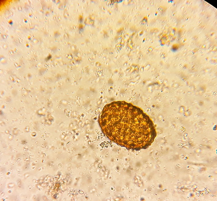 Die Arbeit ruft..Ascaris lumbricoides..