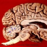 Cerebellum